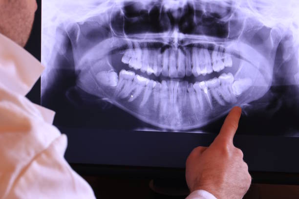 Best Emergency Dental Surgery in Tiffin, OH